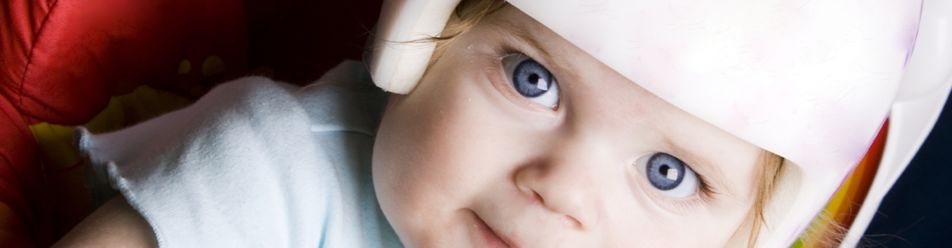 Torticollis & Plagiocephaly